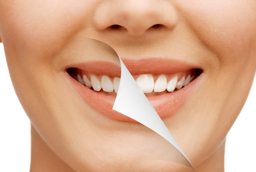 Smile Makeover - Kitsilano dentist Smile Makeover - Kitsilano dentist